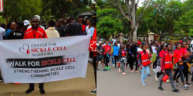 Sickle Cell